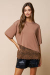 Loose Fit Lace Hem Top